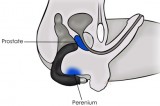 Rude - Boy Mužský vibrátor na masáž prostaty | B, C, A