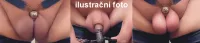 Feminizační spona kovová